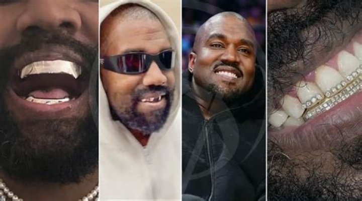 Kanye West's Unique Smile: The Story Behind His Teeth