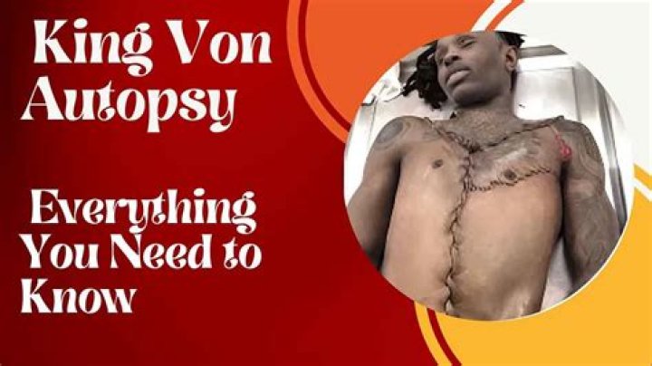 Grisly Details Emerge In King Von Autopsy Report