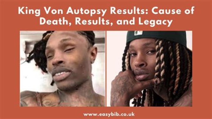 Unveiling The Truth: King Von's Autopsy Photo And Its Impact On Fans And Media