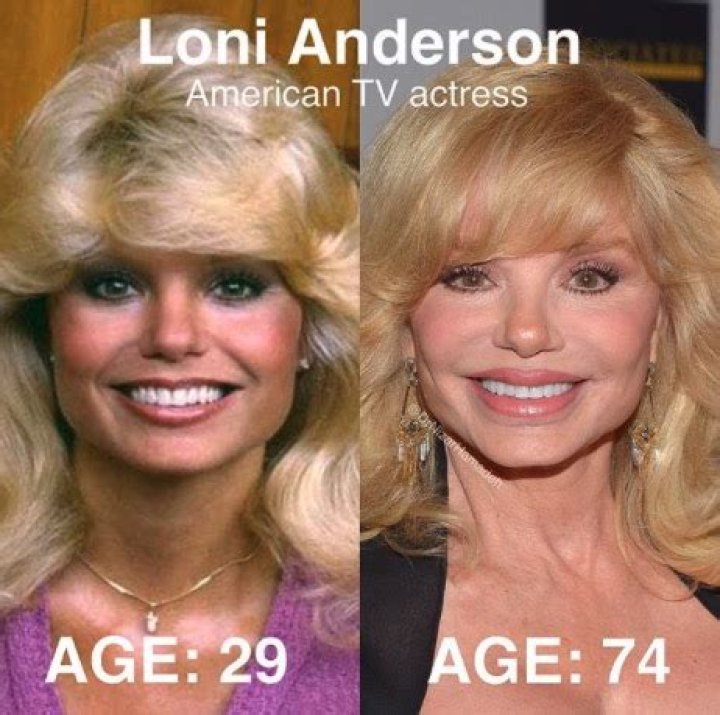 Legendary actress Loni Anderson looks just as good at 78 years old