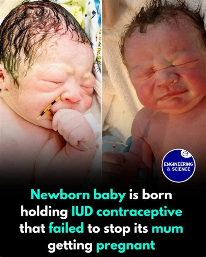 Baby born with IUD in hand? Epic fail goes viral on internet – India TV