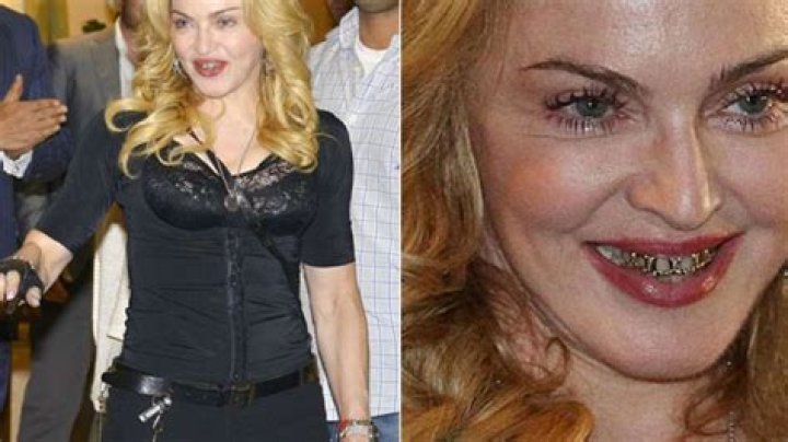 OMG! Madonna looks horrifying in those gold grills – India TV
