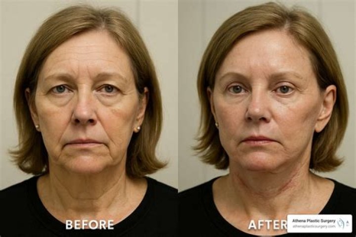 Michael Cole Botches Candice LeRae’s Name On 10/30 WWE RAW By Mistaking Her With Former Talent