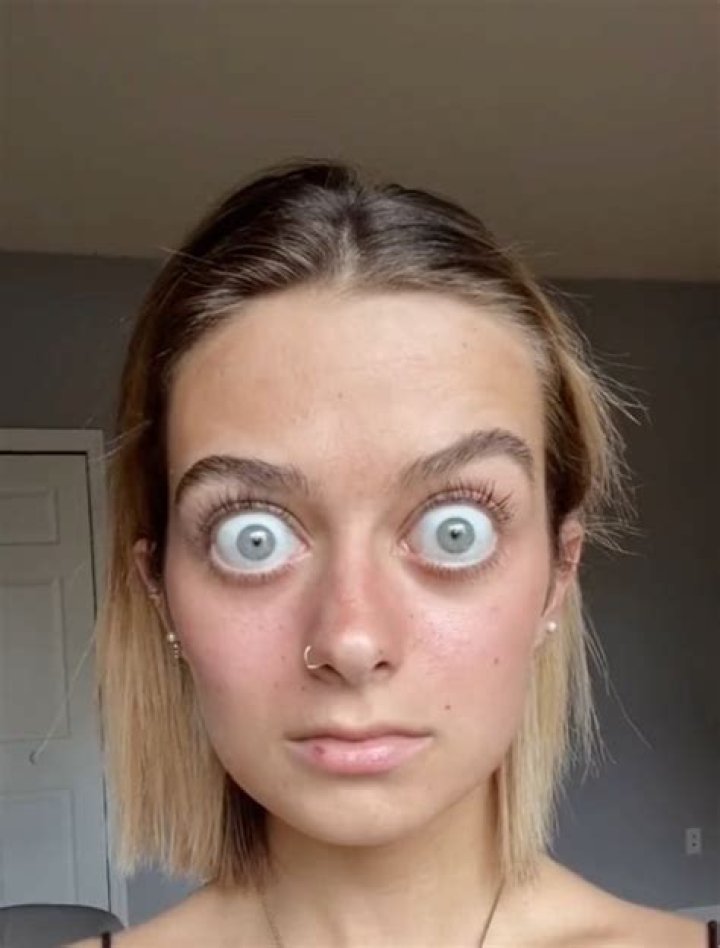 Enigmatic Allure: The Fascinating World Of People With Huge Eyes