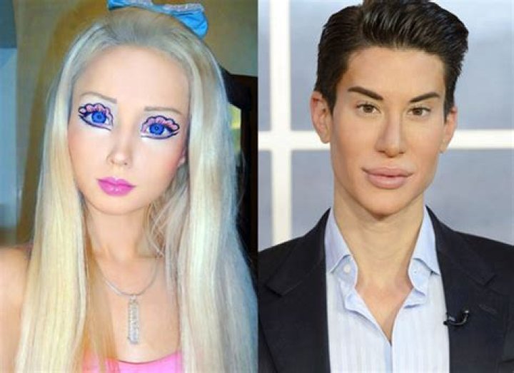 Unveiling The Transformation: The Phenomenon Of Plastic Surgery Ken