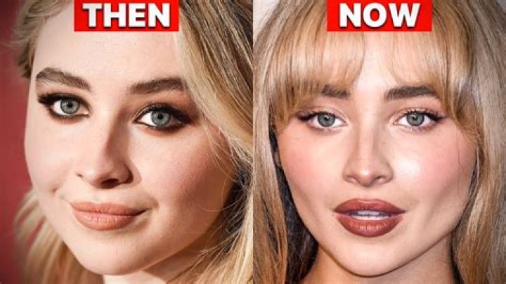 Sabrina Carpenter Filler: The Truth Behind Her Transformation