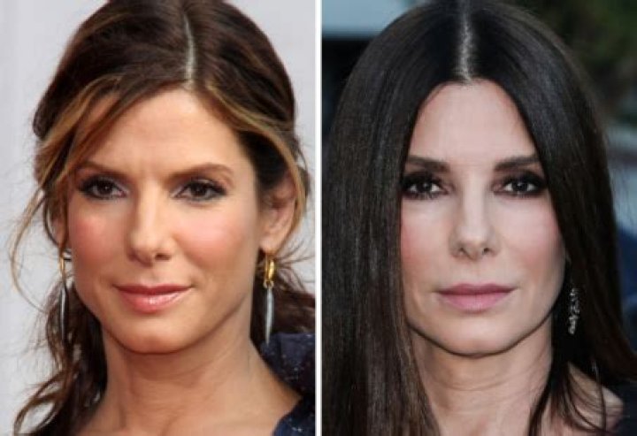 Exploring Sandra Bullock's Plastic Surgery Journey: Truth Behind The Transformation