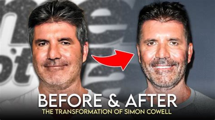 Understanding Simon Cowell's Sickness: A Deep Dive Into His Health Journey