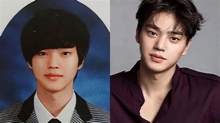 Song Kang Plastic Surgery: Understanding The Transformation Of A Rising Star