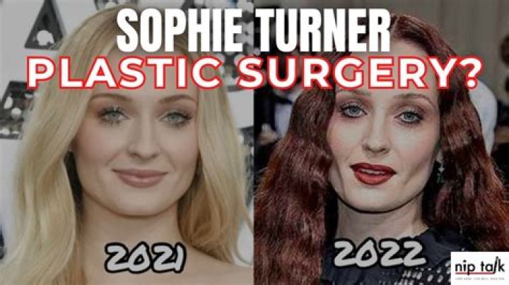 Sophie Rain Surgery: A Comprehensive Overview