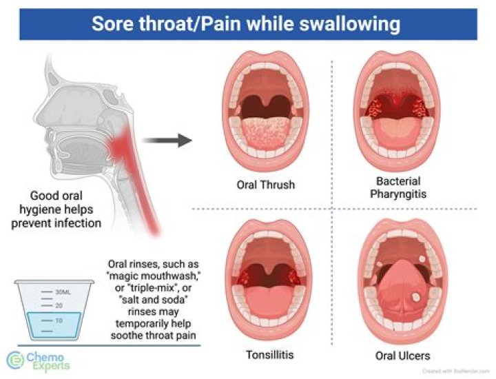 Sucking on ice cubes can help alleviate sore throat; find out – India TV