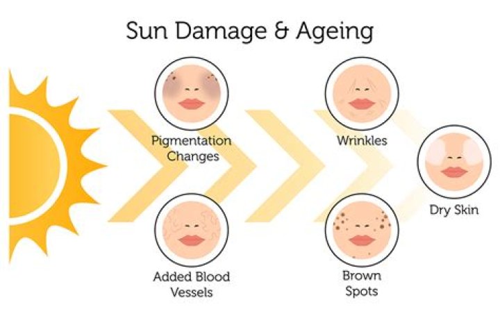 Sun Damaged Skin - Signs And Symptoms To Look For in 2023