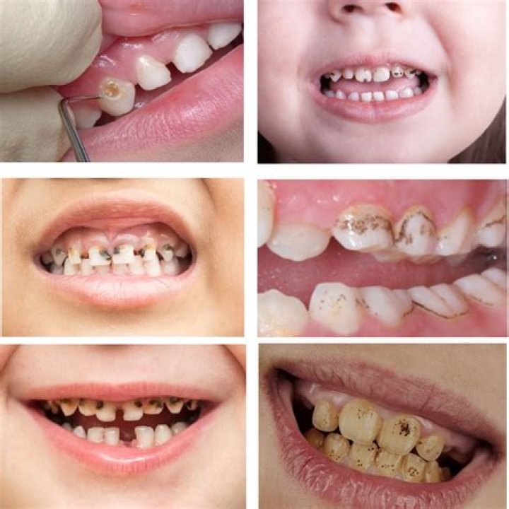 Teen Reveals Horrifying Method She Used to Avoid 'American Girl Doll Teeth'