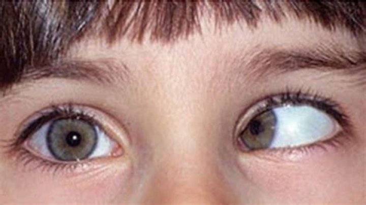Exploring The Enigmatic Beauty Of Ti Eyes