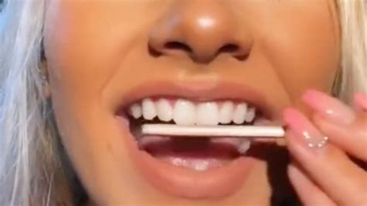Dentists Blast Dumbest New TikTok Trend: Nail-Filing Teeth
