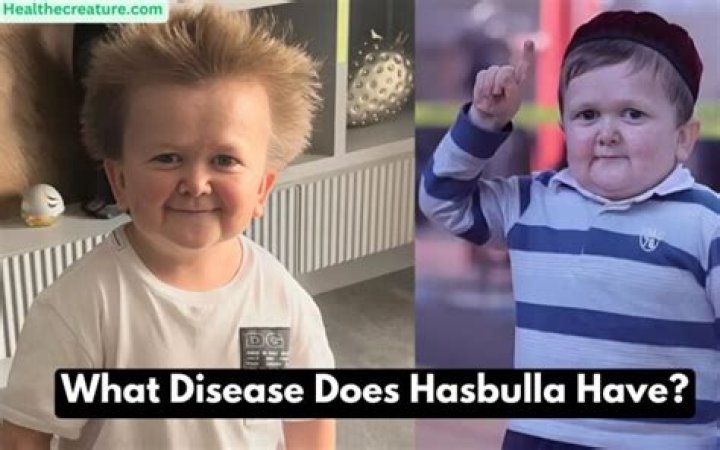 What Disease Does Hasbulla Have? Understanding His Condition And Its Impact