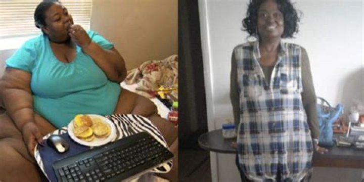 What Happened To 'My 600-Lb. Life' Subject Liz Evans? Lymphedema Growths Leave Her in 'Excruciating' Pain