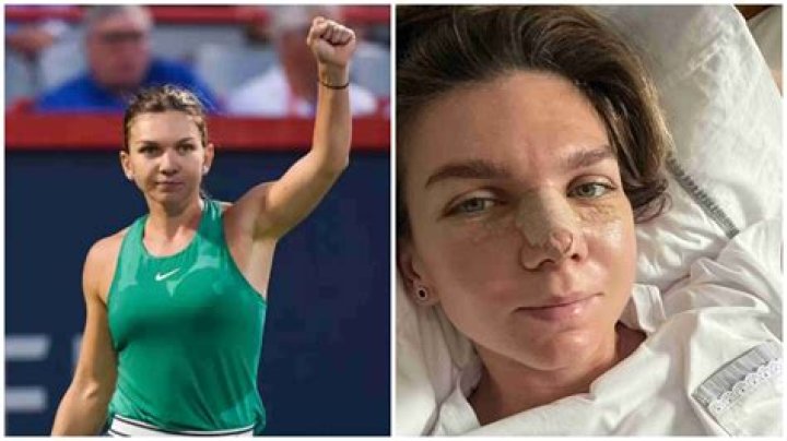 When Romanian tennis sensation Halep underwent breast reduction surgery – India TV