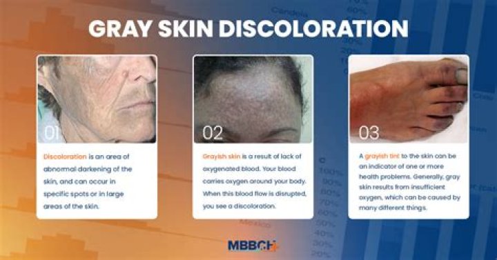 Why Is My Skin Turning Grey