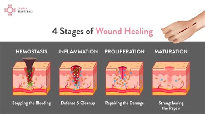 Uncover The Surprising Truth: Do Tendons Heal On Their Own?